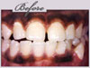 new york orthodontics